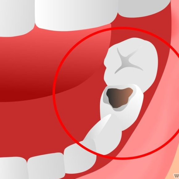 Restauração e Estética